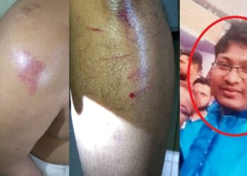 সাভারে জামায়াতের ফ্রি মেডিকেল ক্যাম্পে বিএনপি’র হামলা, আহত ৩