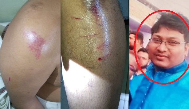 সাভারে জামায়াতের ফ্রি মেডিকেল ক্যাম্পে বিএনপি’র হামলা, আহত ৩